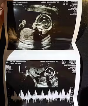 Original Instagram post by @Erynn_wilson_12 I am a 21 year old on a health and non toxic kik.